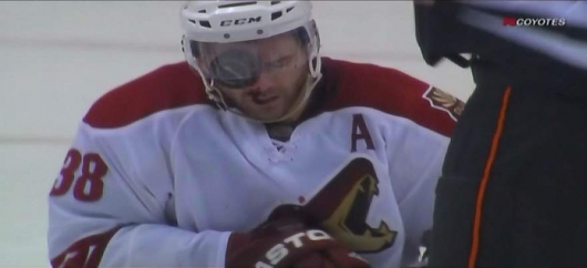 Hockey - you're doing it wrong
