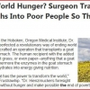 An end to world hunger An end to world hunger