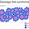 Sausage fest syndrome Sausage fest syndrome