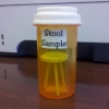 Literal stool sample Literal stool sample